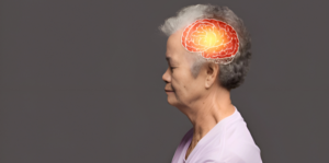Alzheimer’s Disease Treatment in India