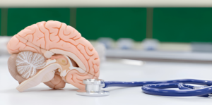 Brain Aneurysm Treatment in India