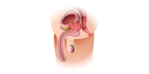 Erectile Dysfunction Treatment in India