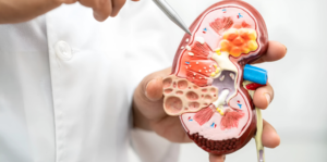 Kidney Stones Treatment in India